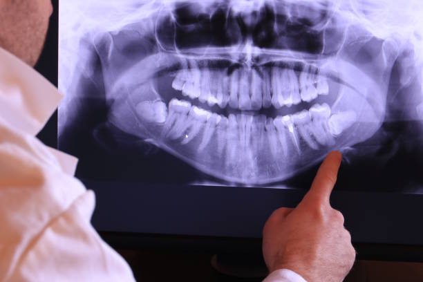 Best Teeth Whitening  in Oswego, KS