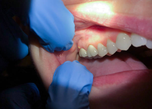 Best Broken Tooth Emergency  in Oswego, KS
