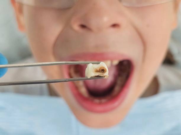 Best Broken Tooth Emergency  in Oswego, KS